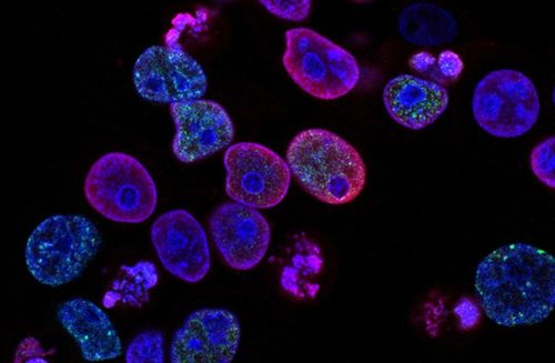 瑞士生物科技公司invasight利用突破性的細胞間蛋白靶點發(fā)現(xiàn)平臺,開發(fā)蛋白質(zhì) 蛋白質(zhì)相互作用抑制劑,靶向治療侵襲性癌癥 瑞士創(chuàng)新100強